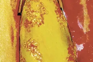 vestido-con-flores